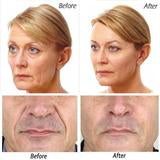 Load image into Gallery viewer, 24k Gold Moisturizing Essence---Solve 99% Of Skin Problems