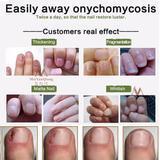 Load image into Gallery viewer, Absolute Nail Treatment Cream