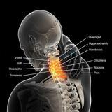 Load image into Gallery viewer, Air Cervical Soft Neck Brace Device