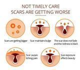 Load image into Gallery viewer, Crocodile Scar Removal Serum