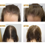 Load image into Gallery viewer, Hair ReGrowth Serum