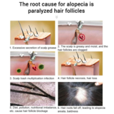 Load image into Gallery viewer, Hair ReGrowth Serum