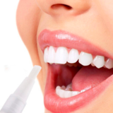 Load image into Gallery viewer, Instant Teeth Whitening Pen