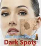 Load image into Gallery viewer, ULTRA BRIGHTENING SPOTLESS OIL