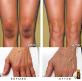 Load image into Gallery viewer, ULTRA BRIGHTENING SPOTLESS OIL