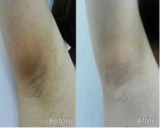 Load image into Gallery viewer, ULTRA BRIGHTENING SPOTLESS OIL