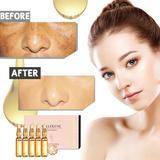 Load image into Gallery viewer, Whitening Spotless Ampoule Serum (Set of 7) Safe and Not Allergic, For Both Men and Women