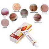 Load image into Gallery viewer, Youthful Scar Rejuvenating Cream