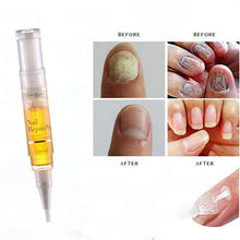 Load image into Gallery viewer, Advanced Fungal Nail Repair Pen