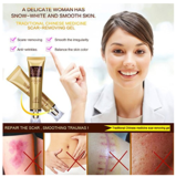 Load image into Gallery viewer, Acne Scar Removal Cream
