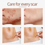 Load image into Gallery viewer, Crocodile Scar Removal Serum
