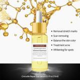 Load image into Gallery viewer, Crocodile Scar Removal Serum
