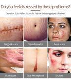 Load image into Gallery viewer, Crocodile Scar Removal Serum
