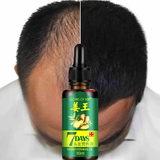 Load image into Gallery viewer, NATURAL 7 DAY HAIR GROWTH SERUM
