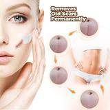 Load image into Gallery viewer, Youthful Scar Rejuvenating Cream
