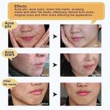 Load image into Gallery viewer, Youthful Scar Rejuvenating Cream

